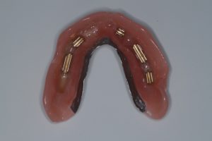 Situatie na: klikgebit