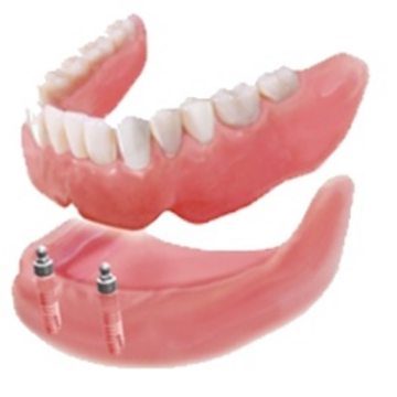 klikgebit op drukknoppen